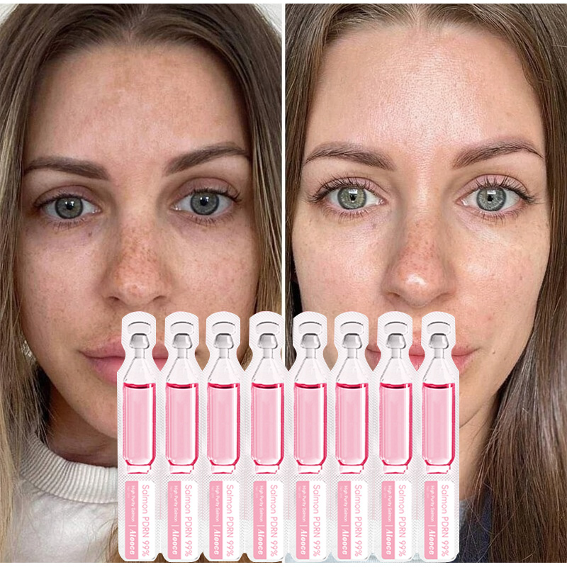 Somon Serumu Protein Peptid Öz - Peptide Complex Serum incelemesi ve fiyatı