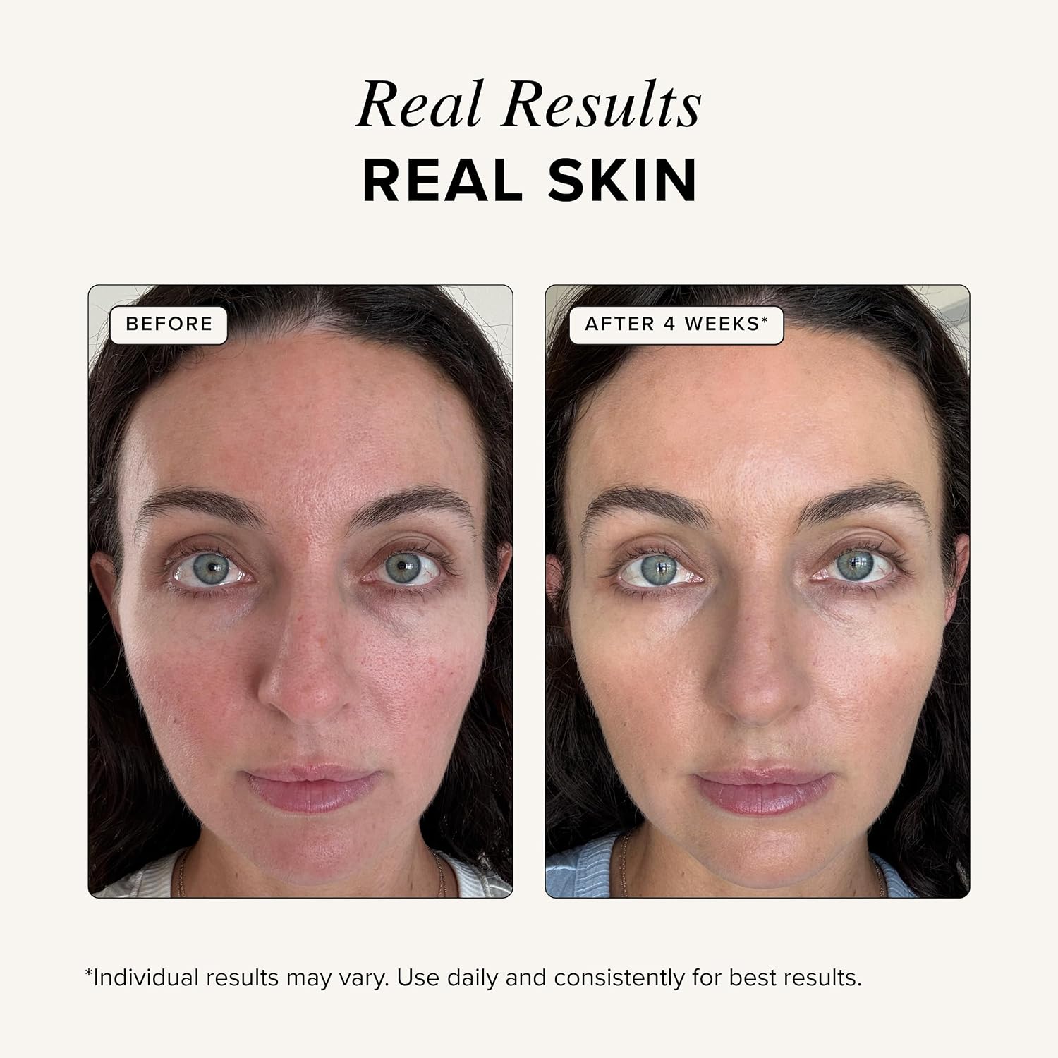 Bakır Peptit Serumu Kırışıklık - Peptide Complex Serum incelemesi ve fiyatı